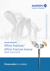 Mathys Affinis Fracture Inverse Operationstechnik
