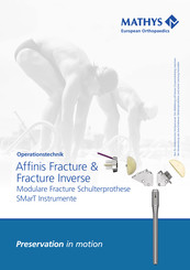 Mathys Affinis Fracture Inverse Operationstechnik