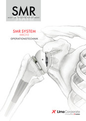 Limacorporate SMR Elektiv Anatomisch Operationstechnik