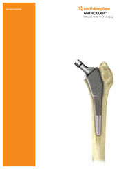 Smith & Nephew ANTHOLOGY Operationstechnik